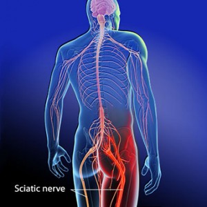 sciatica-s2-sciatic-nerve